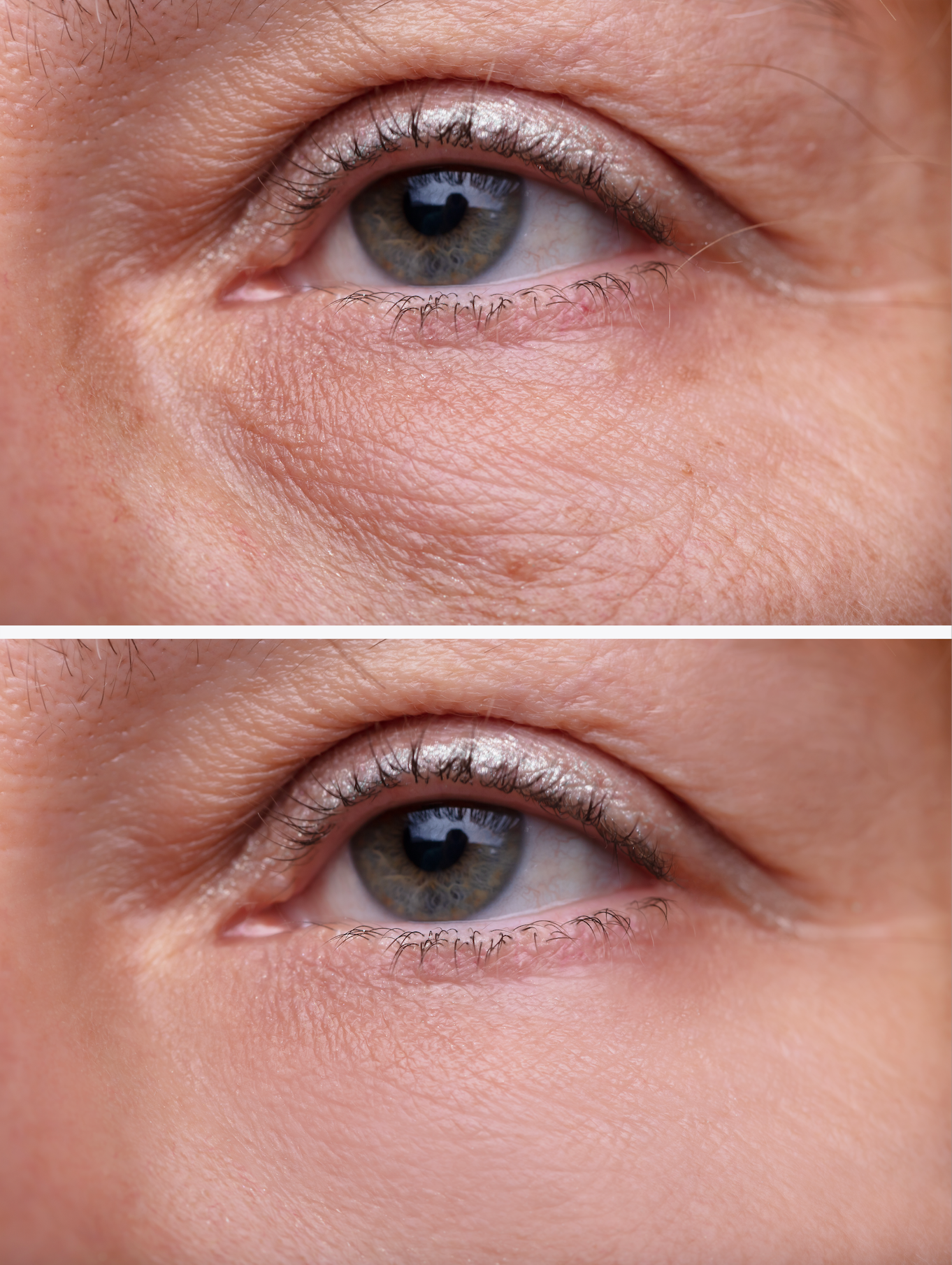 WES Dark Circle Remover