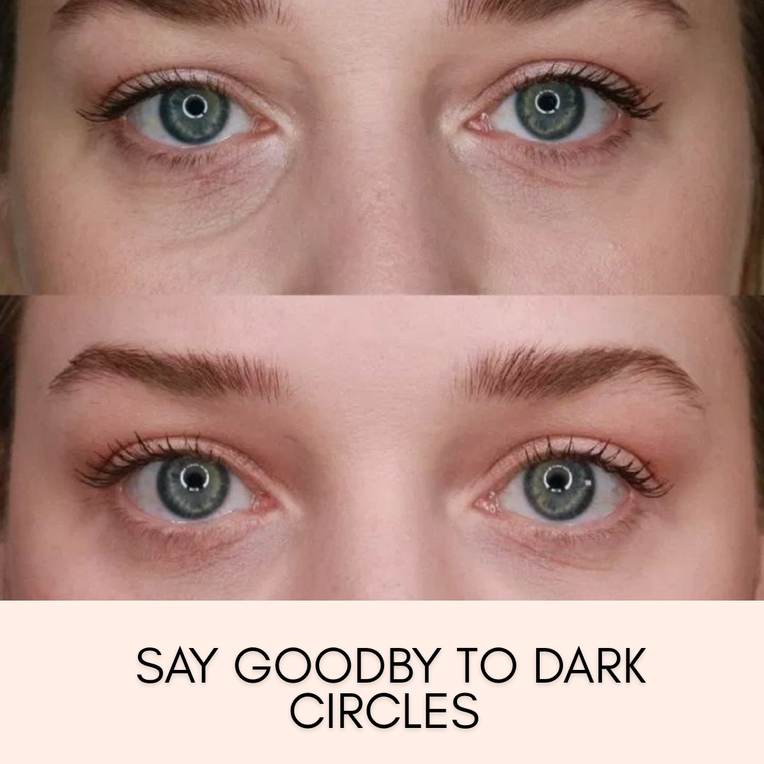 WES Dark Circle Remover