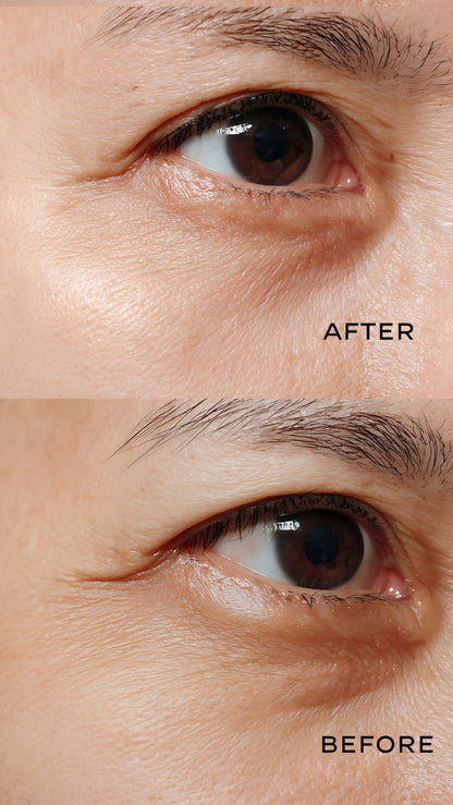 WES Dark Circle Remover