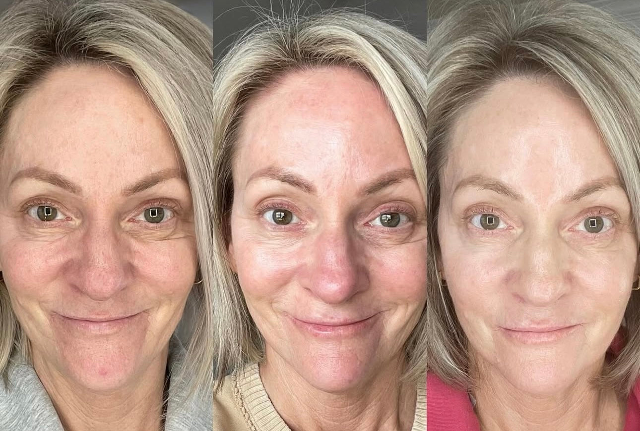 WES Dark Circle Remover