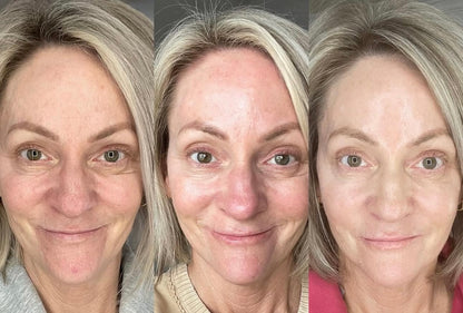 WES Dark Circle Remover