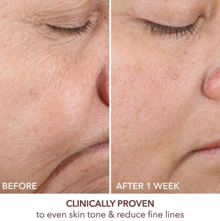 WES Dark Circle Remover